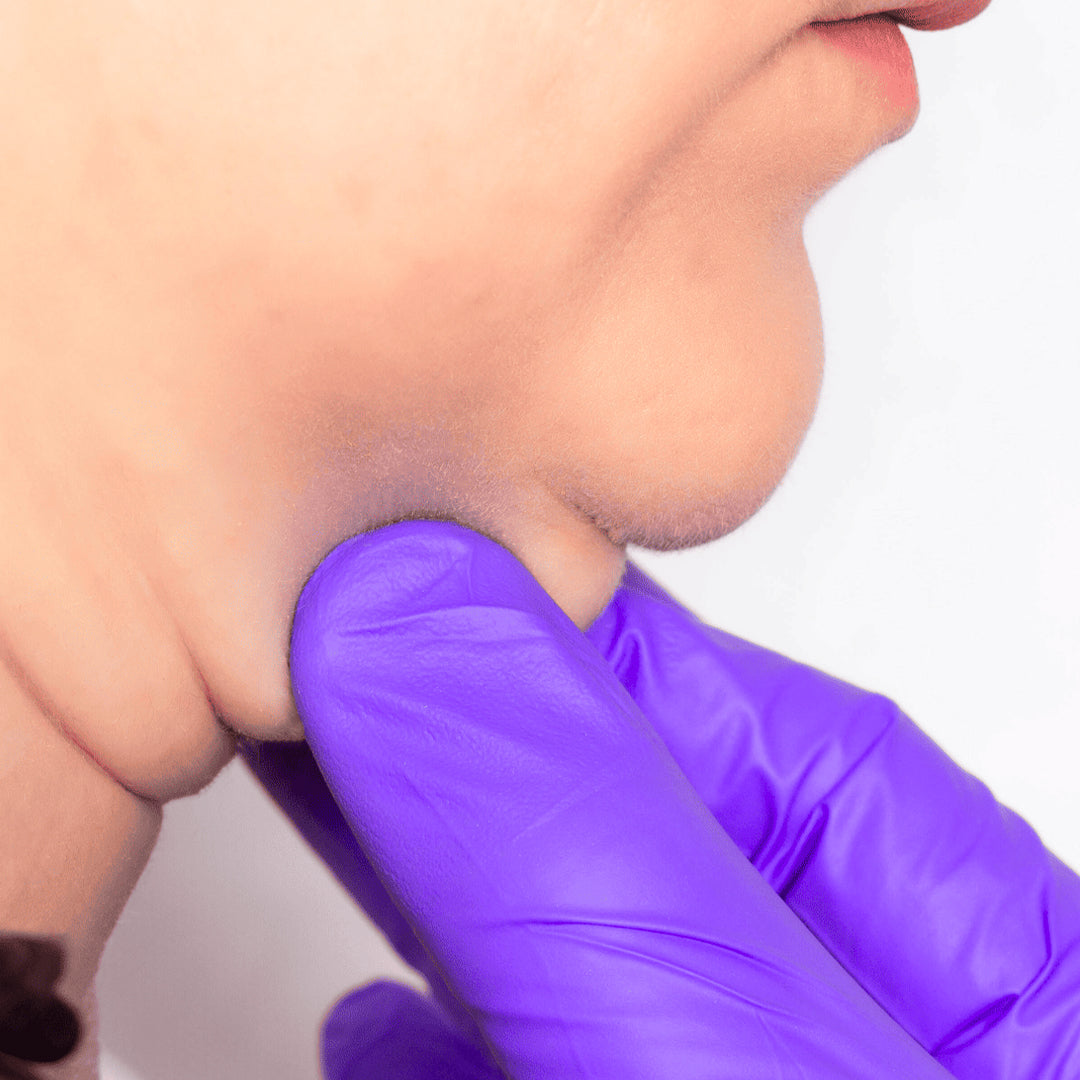 LIPOPAPADA ENZIMATICA