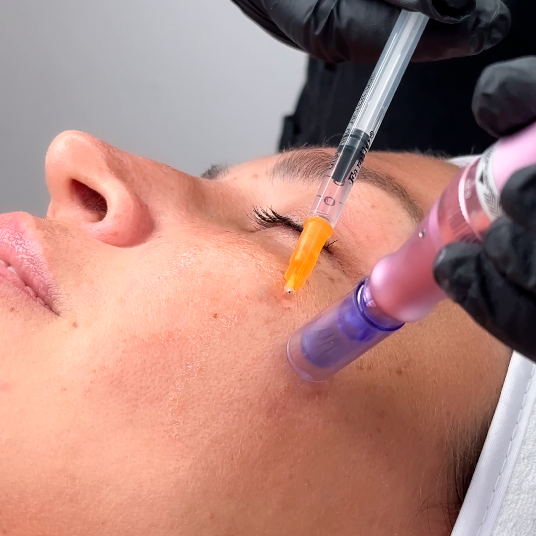 TRATAMIENTO FACIALES LIMA