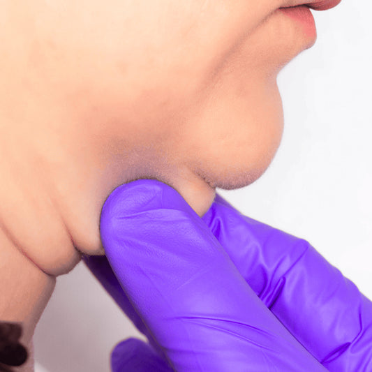 LIPOPAPADA ENZIMATICA