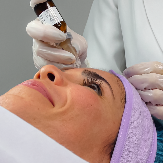 Peeling Facial (PQAGE)