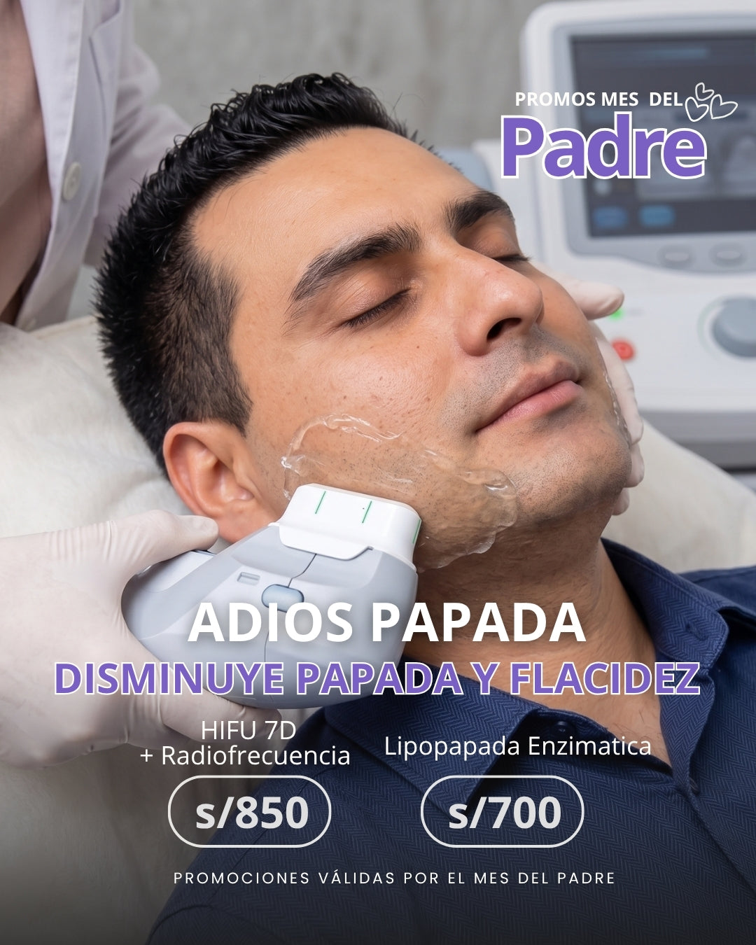 PAPA SIN PAPAPA