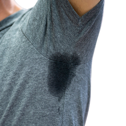 HIPERHIDROSIS