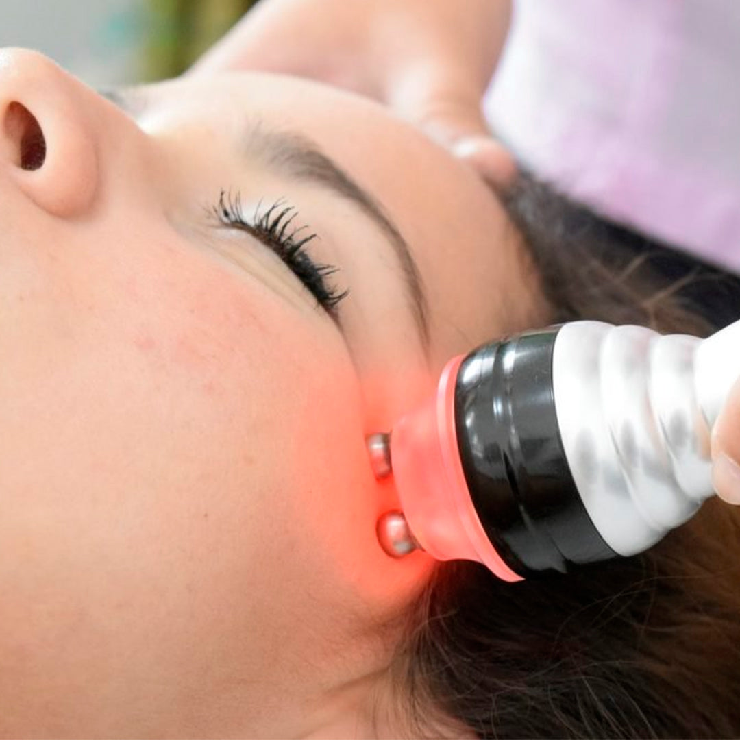RADIOFRECUENCIA FACIAL